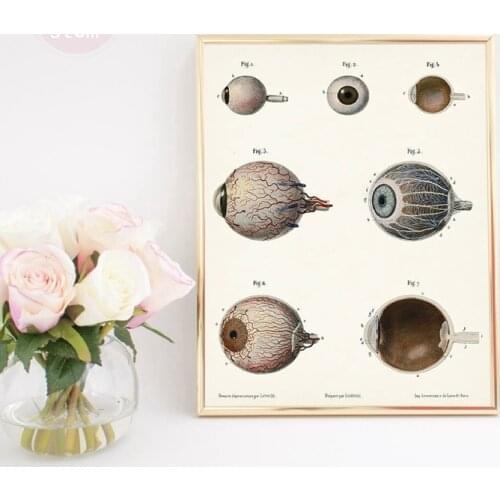 Human Eye Print Optometrist Gifts Anatomy Poster Optometry Decor Clinic Wall Art Canvas Painting Medical School Eye Diagram