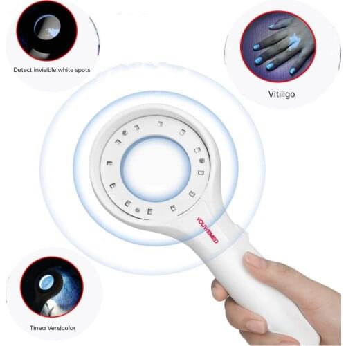 Vitiligo Pityriasis Skin Examination Versicolor Medical Woods Lamp Skin Fungus Detector Melasma Detector Woods Light