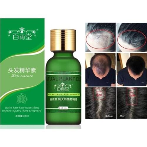 Hair Care Hair Growth Essential Oils Essence Original 100% Hair Loss Liquid Health Care Beauty Dense Hair Growth Serum