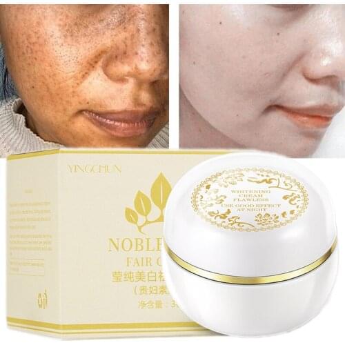 Face Cream Moisturizing Concealer Brighten Fade Acne Marks Pores Spots Oil Control Anti-Aging Lift Firm Aloe Vera Skin Care 30g