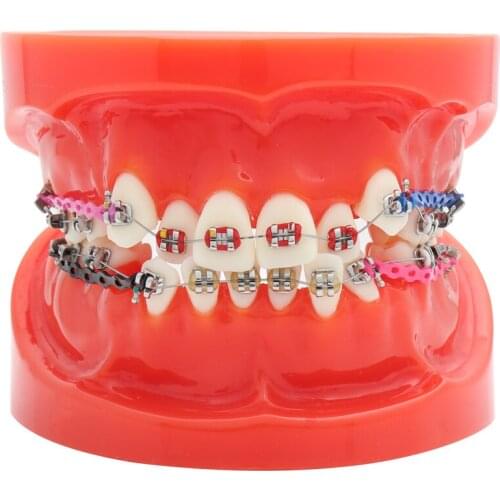 Dental Standard Orthodontic Teeth Model with Brackets & Buccal Tubes & Ligature Wire Orthodontic Treatment Red