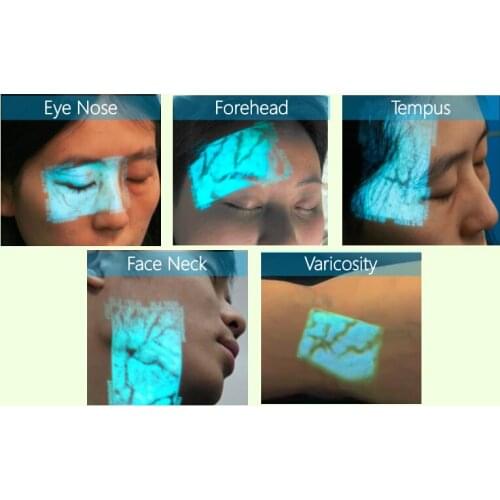 Handheld Clinic Vein Finder/Scanner/Viewer/Locator/Reader