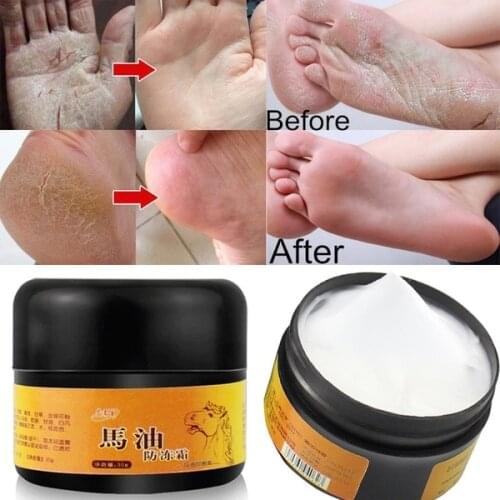 1pc Horse Oil Feet Cream Care Beriberi Cream for Athletes Foot Feet Itch Blisters Anti-chapping Peeling Beriberi Bad Feet Ointm
