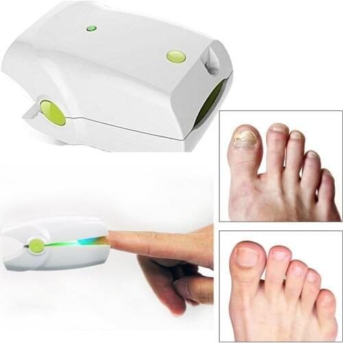 Nail Fungus onychomycosis Infection Treatment LLLT Cold Laser Light therapy Home Use Foot Fungus Nails Anti Fungal