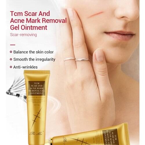 Acne Scar Removal Cream Gel Face Pimples Stretch Marks Cream Repairing Smoothing Whitening Moisturizing Body Cream Skin Care 30g