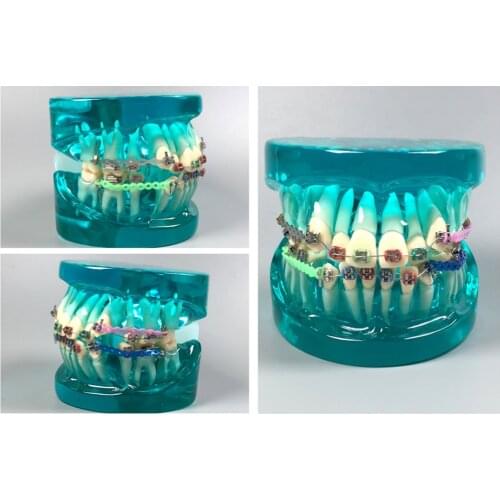 Clear Dental Study Model Orthodontic Demonstrate School Teaching Tool Crystal Translucent Ceramic