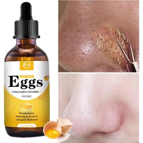 Minch Egg Face Serum Blackhead Remove Essence Pore Minimizer Oil Control Shrink Pores Serum Whitening Serum Korea Skin Care Oil