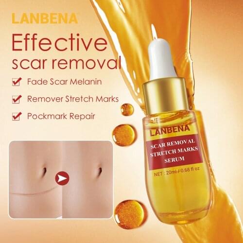 LANBENA Acne Treatment Acne Scar Remove Serum Remover Stretch Marks Anti Acne Shrink Pores Blackhead Whitening Cream Skin Care