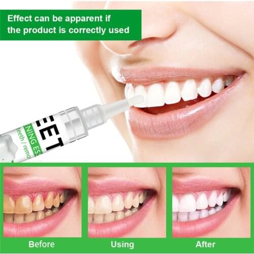Teeth Whitening Pen Cleaning Serum Remove Plaque Stains Dental Tools Perfect Smile White Tooth Oral Bleaching Teeth Whitener