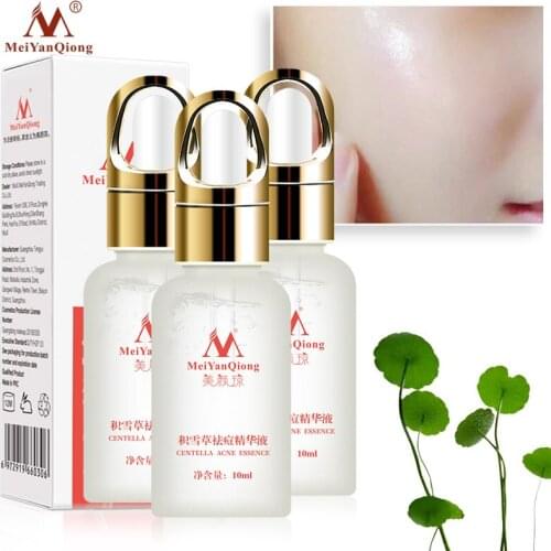 3pcs/lotMeiYanQiong Centella asiatica acne extract removes acne, eliminates acne marks, controls oils, and whitens skin 10ml