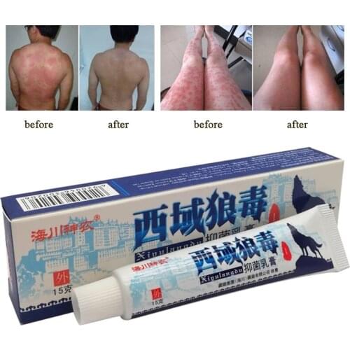 15g Western Wolf Venom Antibacterial Cream Extract 29A Psoriasis Cream Dermatitis Eczema Eczema Ointment Whitening Care Cream