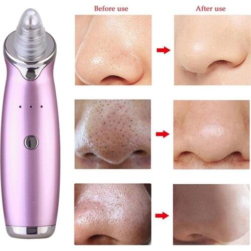 Vieruodis Facial Care Tools