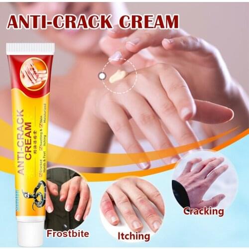 Sink Care Chapped Hands And Feet Cream Repair Frostbite Dry Cracked Snakes Oil Plaster Anti-Itch Moisturizing Cream SSwell