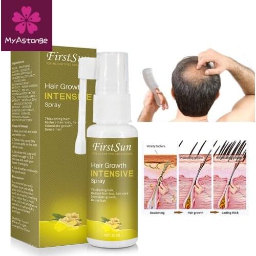Alopecia Cure Organic Herbal Fast Hair Growth Spray Treatment for Hair Regrowth Oil for Women Men Prevent Hair Loss Serum 30ml