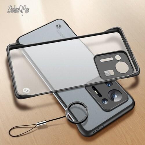 XUANYAO Xiaomi Mi Mix Phone Cases