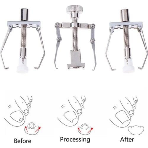 Ingrown Toenails Correction Pedicure Foot Toe Nail Care Tools File Elastic Patch Straightening Clip Brace Corrector Wire Fixer