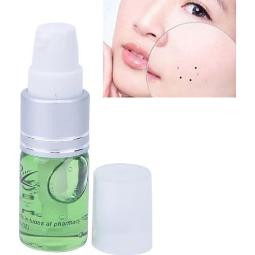 Freckle Repair Cream Oil Mole & Skin Tag Repair Solution Painless Mole Skin Dark Spot Repair Face Wart Tag