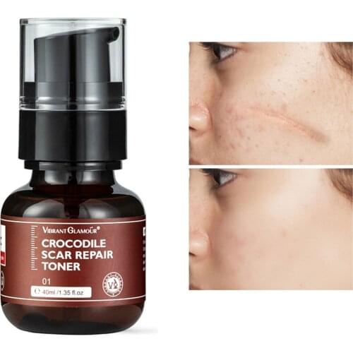 VIBRANT GLAMOUR Crocodile Scar Repair Toner Reduce Scar Area Fade Scar Color Prevent Scar Hyperplasia Sensitive Skin Deep Care