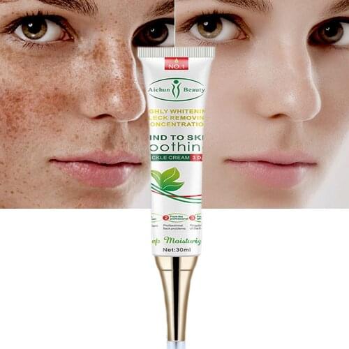 Effective Whitening Freckle Cream Remove Melasma Acne Spot Pigment Melanin Dark Spots Pigmentation Moisturizing Gel Skin Care