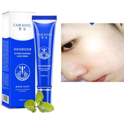15ML Acne Treatment Blackhead Remova Anti Acne Cream Oil Control Shrink Pores Acne Scar Remove Face Care Whitening