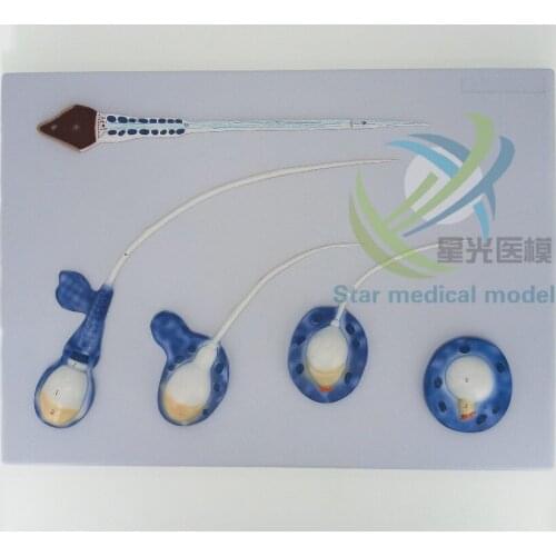 Sperm development model Testicular secretion teaching simulation Simulation of sperm anatomy model free shipping