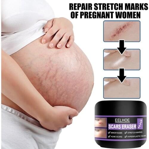 Scar Cold Compress Gel Scar Care Gel Treatment Scar Repair Cream Make The Skin Smooth Soft Removing Acne Antibacterial
