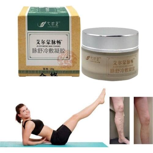 Varicose Veins Cream Of Varicose Veins Medical Spider Veins Treatment Chinese Herbal Medicine Varicose Veins Ointment 20g