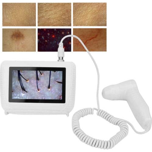 5 Inch Rechargeable Scalp Hair Follicle Oil Moisture Magnifying Detector Analyzer Skin Pigment Tester Hair Follicle Detector