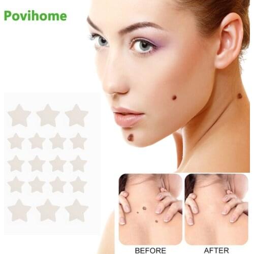 54pcs Skin Tag Remover Warts Remover Patch Skin Tag Treatment Foot Corn Plaster Acne Warts Star Stickers Translucent Outdoor