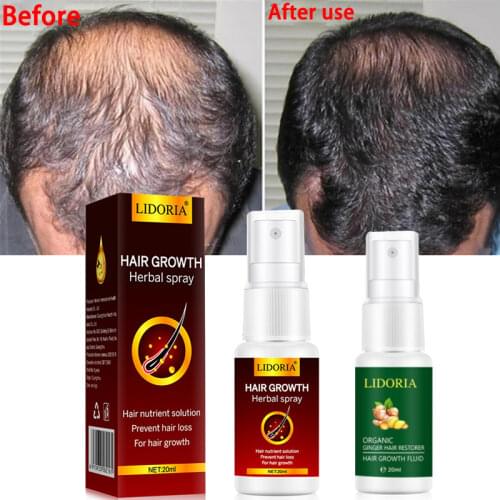 Средства от выпадения волос Qsezeny China At AliExpress