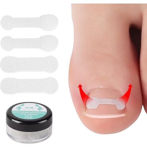 3 Bags Nail Correction Stickers Ingrown Toenail Corrector Patches Nail Correction Stickers General Elastic Patch Foot Care Tool