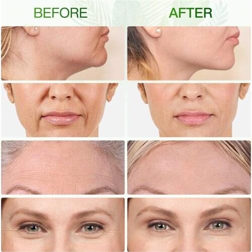 Jade Roller Set - Cosmetic Beauty Instrument Relieve Wrinkles Aging Dark Circles And Muscle Relaxin NN