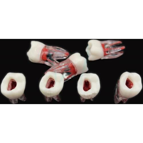 1Pc Dental Tooth model Root Canal RCT Practice Pulp Cavity Clear Resin Teaching teeth model 1:1 Dental Model Dentist Tools