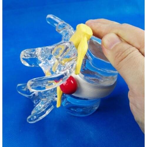 Spine and spinal cord extrusion demonstration model Teaching model of human body medicine