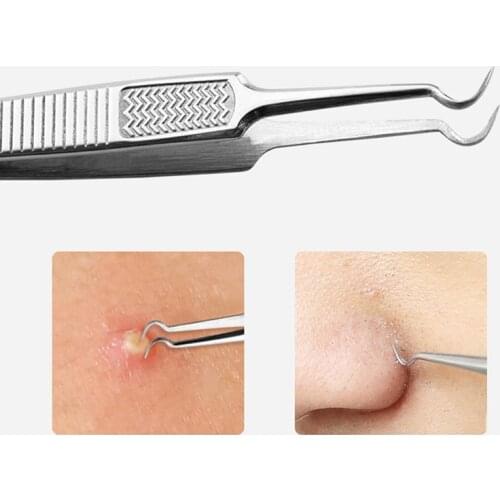 1PC Curved Straight Blackhead Tweezers Double Head Acne Tweezers Anti Slip Stainless Steel Acne Tweezers Needle Removal Tool