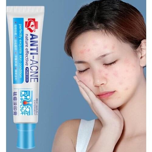 Traditional Chinese Medicine Cream Acne Treatment Shrink Pores Spots Gel Bleaching Creams Whitening Moisturizing Face Cream