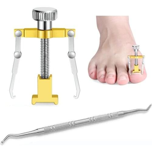 1Set Professional Effective Treatment Ingrown Toenail Correction Pedicure Tools Paronychia Foot Care Nail Recover Toe Fixer