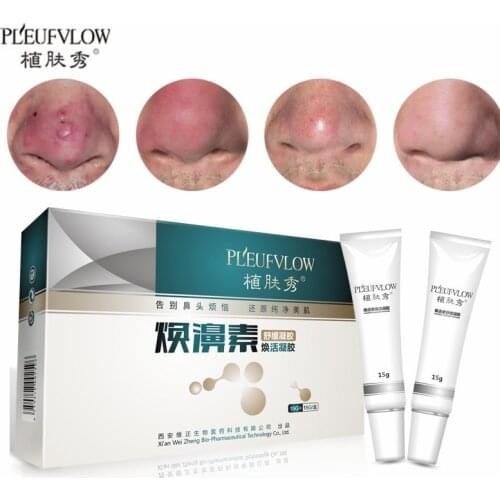 Herbal Anti Nose Mites A+B Set Remove Acne Rosacea Cream Red Nose Blackhead Remover Acne Treatment Shrink Pores Products 15g+15g