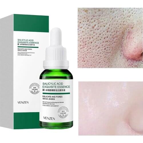 Salicylic Acid Pore Refining Serum Moisturizing Nourishing Firming Whitening Anti-Aging Anti-Wrinkle Facial Skin Care 30ml