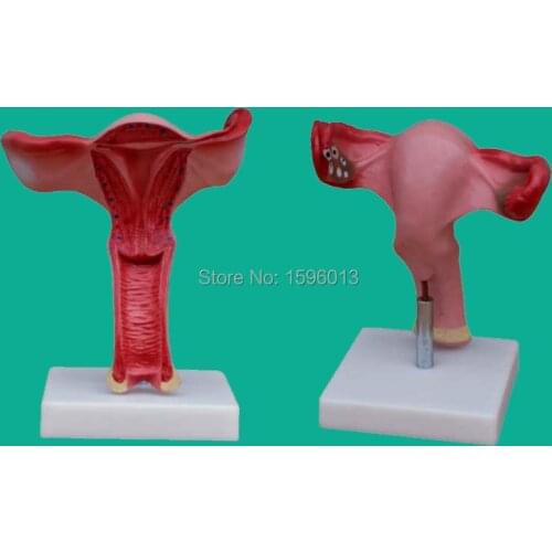 Anatomical Uterus Model, Female Internal Genital Model