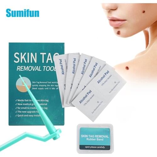 1Set Wart Plasma Remover Tool Skin Tag Kit Skin Care Corn Skin Tag Kill Cleansing Adult Mole Wart Treatment Removal Papillomas