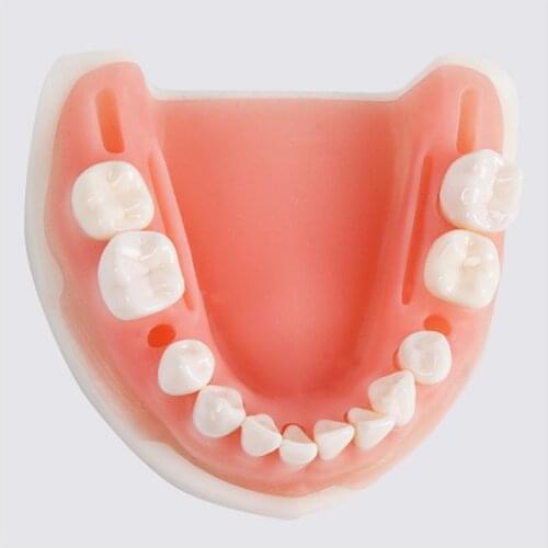 Oral suture model Tooth preparation with teeth Suture medical teaching and training tools Periodontal suture practice