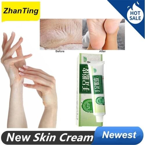 3 Pcs Hand Foot Peeling Horse Oil Feet Cream Athlete Hand Foot Feet Itch Blisters Anti Chapping Peeling Foot Care Cream