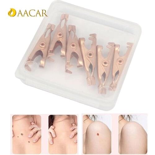 Skin Tags Remover Wart Tattoo Clip Blackhead Skin Blemish Removers Coppers Tags