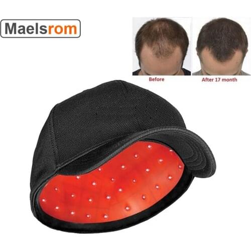 650nm Laser Therapy Hair Growth Helmet Anti Hair Loss Device Anti Hair Loss Promote Hair Regrowth Cap 81 pcs Laser