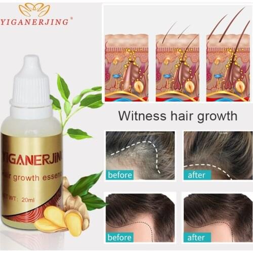 5pcs/lot Hair Growth Essence Hair Loss Liquid 20ml Damage Hair Repair Treatment Dense Hair Grow Fast Restoration Pilatory