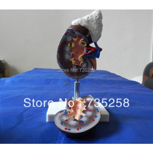 Human Kidney with Adrenal Gland,Adrenal simulation model