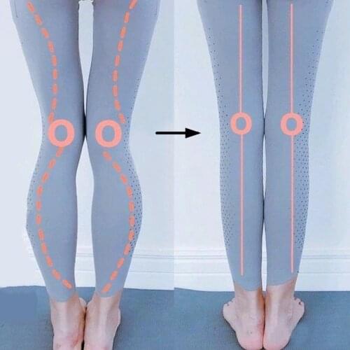 2PCS Insoles Correction Shoe Inserts Pads Effective O/X Type Leg Bowed Legs Knee Valgum Straightening for Women Men Health Care