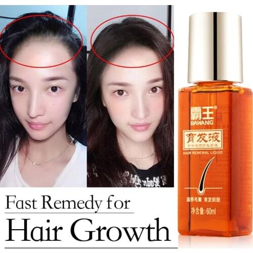 Hair Growth Oil for Fast Hair Growth Agent Against Hair Loss Remedy Treatment Hair Care Thickener Hair Growth Essential Serum