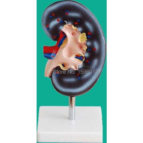 Kidney Model, Anatomical Model of Kidney